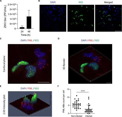 Cellular Organelles Reorganization During Zika Virus Infection of Human Cells